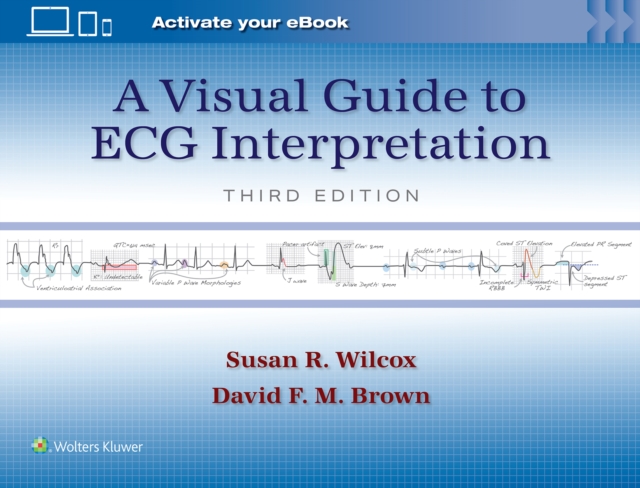 A Visual Guide to ECG Interpretation: Print + eBook with Multimedia, Paperback / softback Book