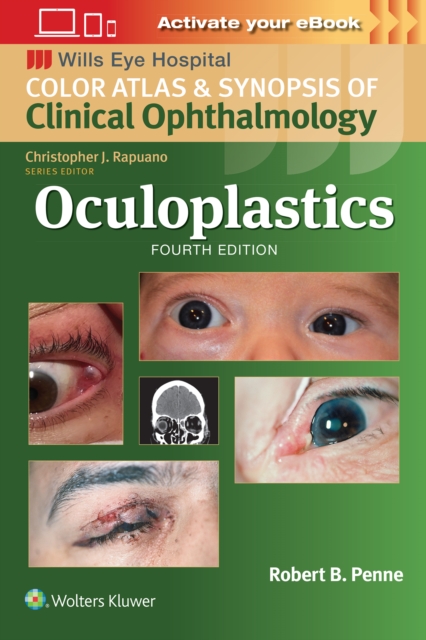 Oculoplastics, Paperback / softback Book
