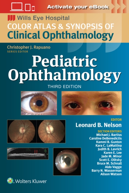 Pediatric Ophthalmology, Paperback / softback Book