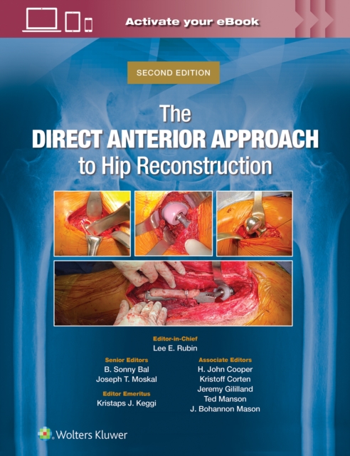 The Direct Anterior Approach to Hip Reconstruction, Hardback Book