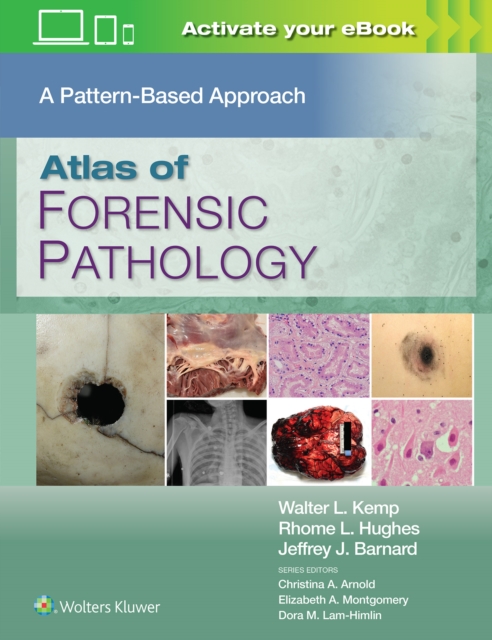 Atlas of Forensic Pathology: A Pattern Based Approach: Print + eBook with Multimedia, Hardback Book