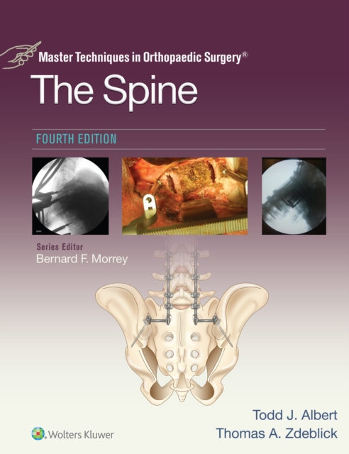 Master Techniques in Orthopaedic Surgery: The Spine, EPUB eBook