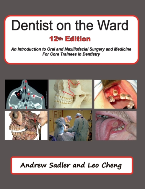 Dentist on the Ward 12th Edition : An Introduction to Oral and Maxillofacial Surgery and Medicine for Core Trainees in Dentistry, Paperback / softback Book