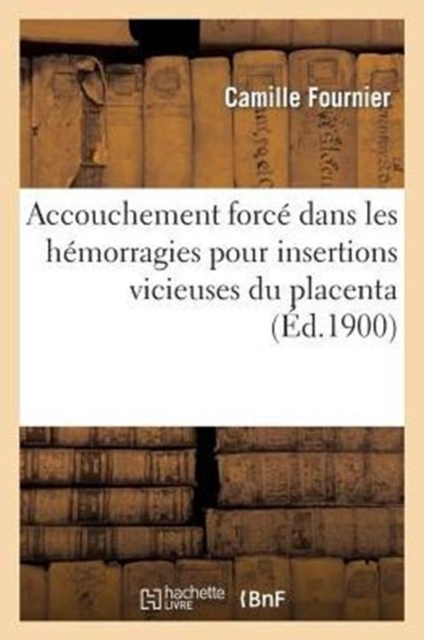 Accouchement Force Dans Les Hemorragies Pour Insertions Vicieuses Du Placenta, Paperback / softback Book