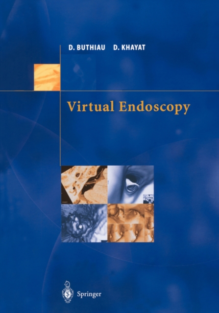 Virtual Endoscopy, Paperback / softback Book
