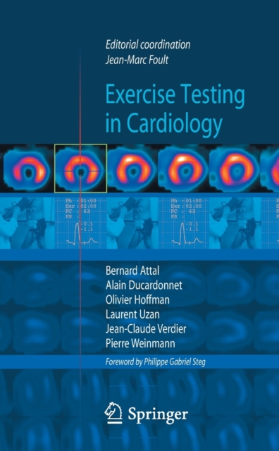 Exercise testing in cardiology, Paperback / softback Book