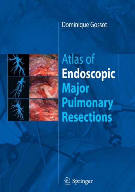 Atlas of endoscopic major pulmonary resections, Paperback / softback Book