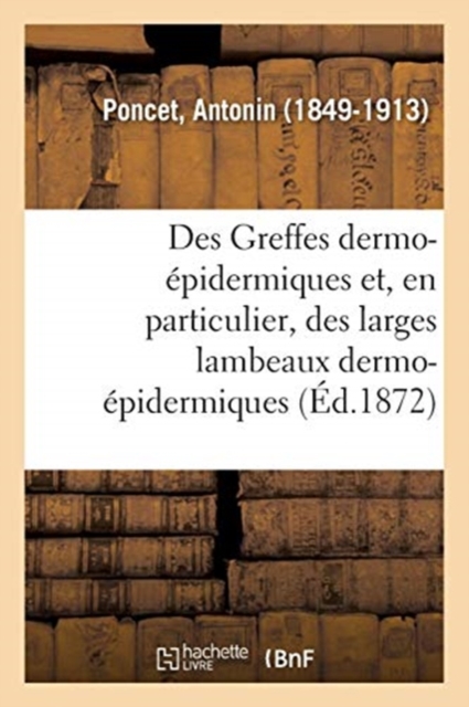 Des Greffes Dermo-?pidermiques Et, En Particulier, Des Larges Lambeaux Dermo-?pidermiques, Paperback / softback Book