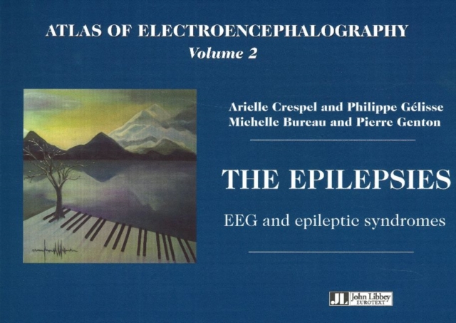 Atlas of Electroencephalography : The Epilepsies - EEG and Epileptic Syndromes Volume 2, Paperback / softback Book