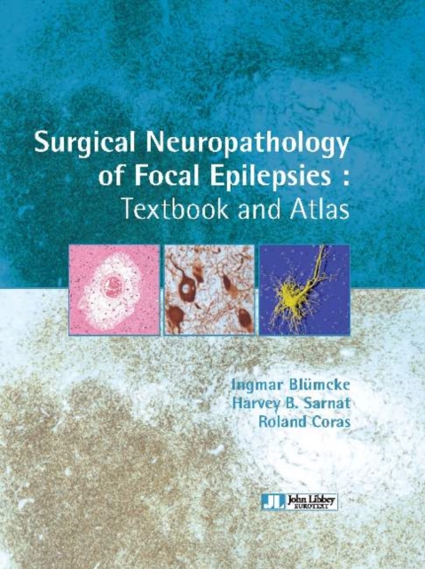 Surgical Neuropathology of Focal Epilepsies : Textbook & Atlas, Hardback Book