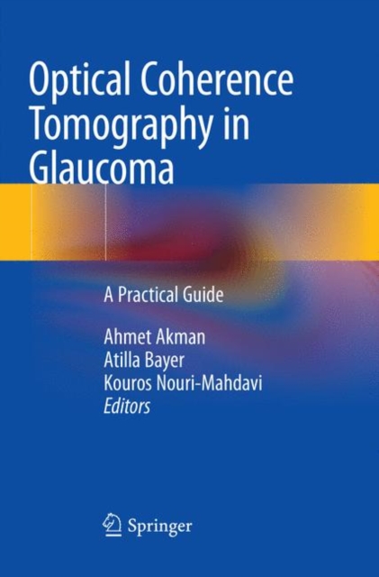 Optical Coherence Tomography in Glaucoma : A Practical Guide, Paperback / softback Book