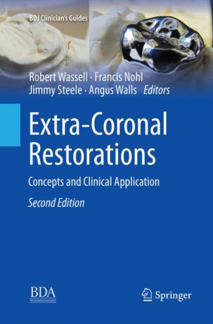 Extra-Coronal Restorations : Concepts and Clinical Application, Paperback / softback Book