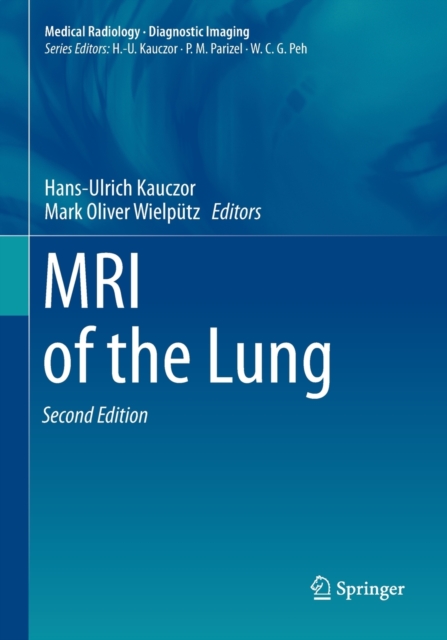 MRI of the Lung, Paperback / softback Book