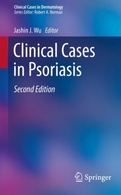 Clinical Cases in Psoriasis, Paperback / softback Book