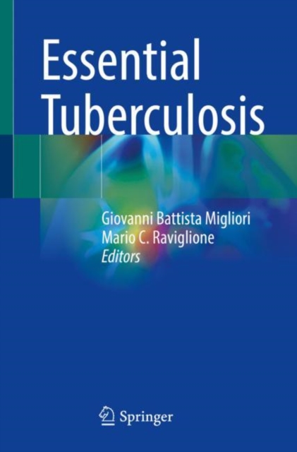 Essential Tuberculosis, Paperback / softback Book