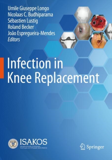 Infection in Knee Replacement, Paperback / softback Book