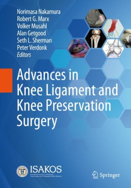 Advances in Knee Ligament and Knee Preservation Surgery, Hardback Book