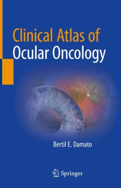 Clinical Atlas of Ocular Oncology, Hardback Book