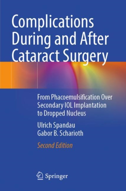 Complications During and After Cataract Surgery : From Phacoemulsification Over Secondary IOL Implantation to Dropped Nucleus, Paperback / softback Book