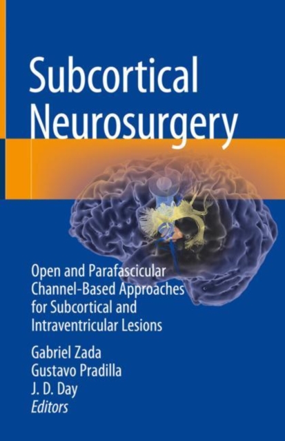 Subcortical Neurosurgery : Open and Parafascicular Channel-Based Approaches for Subcortical and Intraventricular Lesions, Hardback Book