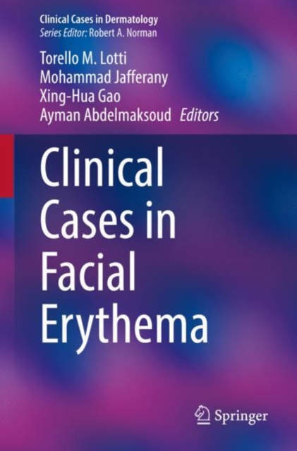 Clinical Cases in Facial Erythema, Paperback / softback Book