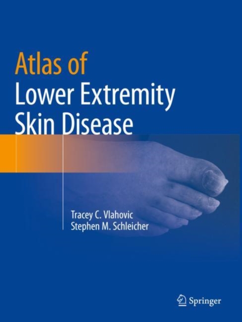 Atlas of Lower Extremity Skin Disease, Paperback / softback Book
