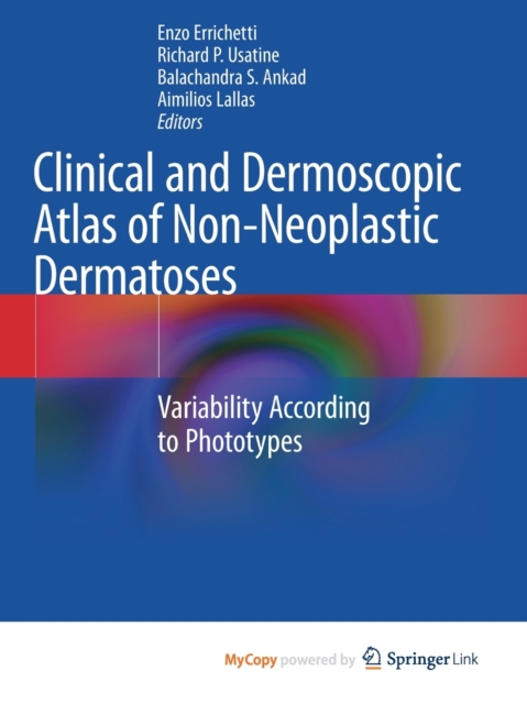 Clinical and Dermoscopic Atlas of Non-Neoplastic Dermatoses : Variability According to Phototypes, Paperback Book