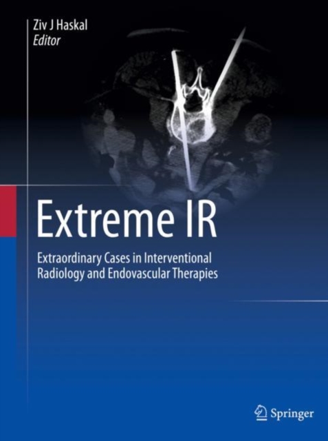 Extreme IR : Extraordinary Cases in Interventional Radiology and Endovascular Therapies, Hardback Book