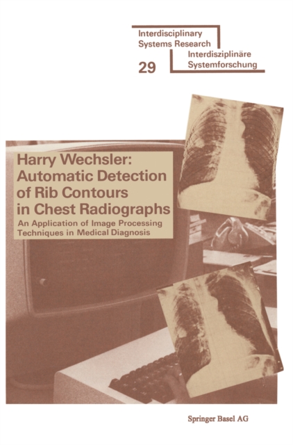 Automatic Detection of Rib Contours in Chest Radiographs : An Application of Image Processing Techniques in Medical Diagnosis, PDF eBook