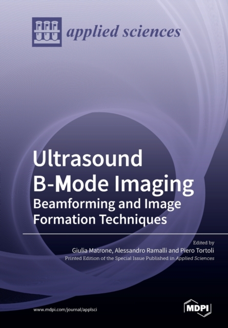 Ultrasound B-Mode Imaging : Beamforming and Image Formation Techniques, Paperback / softback Book
