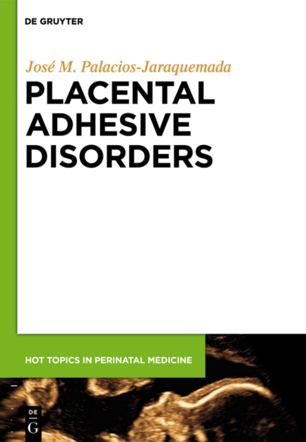 Placental Adhesive Disorders, PDF eBook