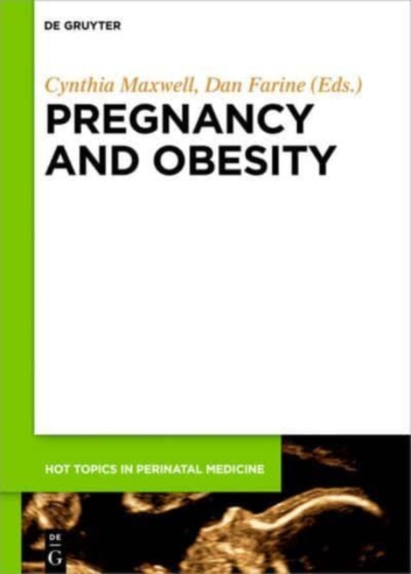 Pregnancy and Obesity, Hardback Book