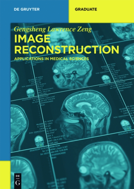 Image Reconstruction : Applications in Medical Sciences, PDF eBook