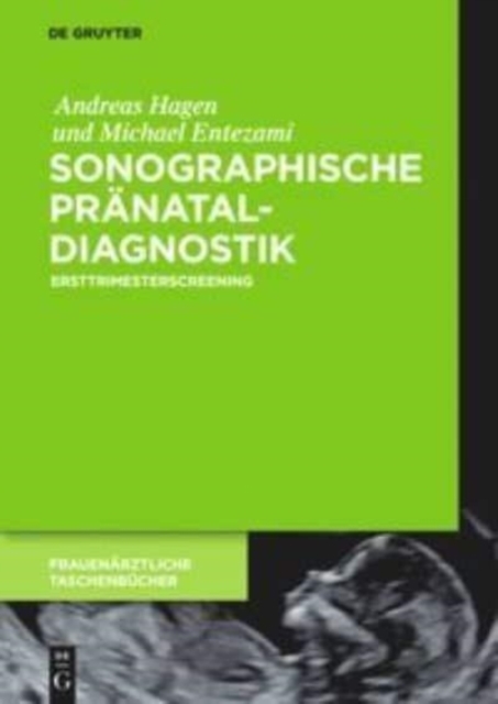 Sonographische Pranataldiagnostik : Ersttrimesterscreening, Hardback Book