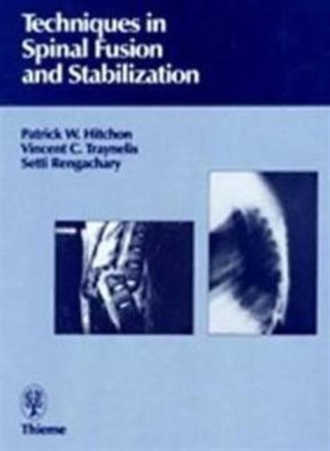 Techniques in Spinal Fusion and Stabilization, Hardback Book