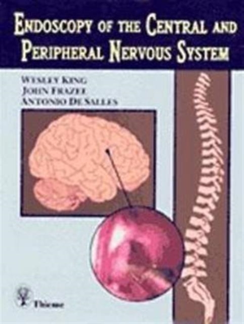 Endoscopy of the Central and Peripheral Nervous System, Hardback Book