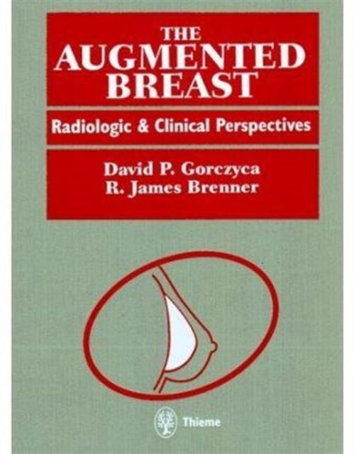 The Augmented Breast : Radiological and Clinical Perspectives, Hardback Book