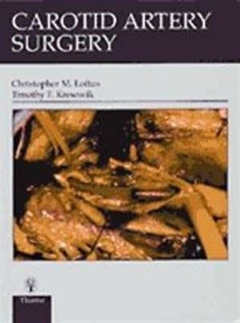 Carotid Artery Surgery, Hardback Book