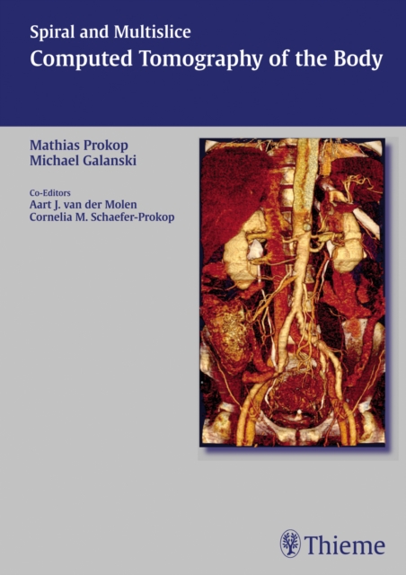 Spiral and Multislice Computed Tomography of the Body, Hardback Book