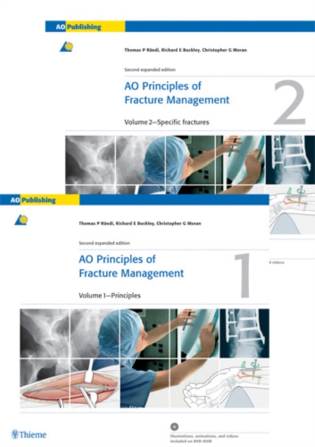 AO Principles of Fracture Management : Vol. 1: Principles, Vol. 2: Specific fractures, Hardback Book