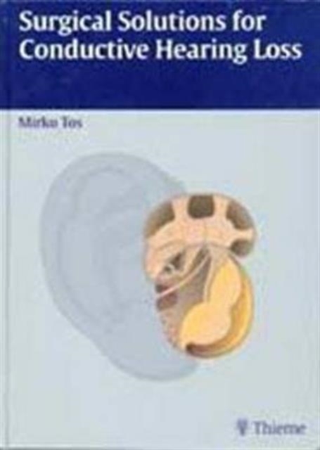 Surgical Solutions for Conductive Hearing Loss : Man Middle Ear Surgery Volume 4, Hardback Book