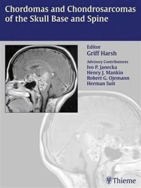 Chordomas and Chondrosarcomas of the Skull Base and Spine, Hardback Book