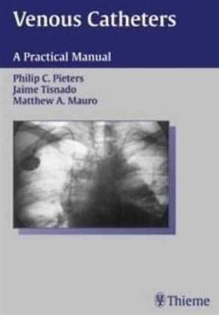 Venous Catheters : A Practical Manual, Hardback Book