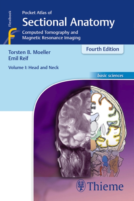 Pocket Atlas of Sectional Anatomy, Volume I: Head and Neck : Computed Tomography and Magnetic Resonance Imaging, Paperback / softback Book