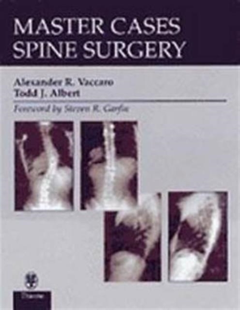 MasterCases in Spine Surgery, Hardback Book