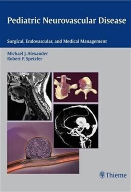Pediatric Neurovascular Disease : Surgical, Endovascular and Medical Management, Hardback Book