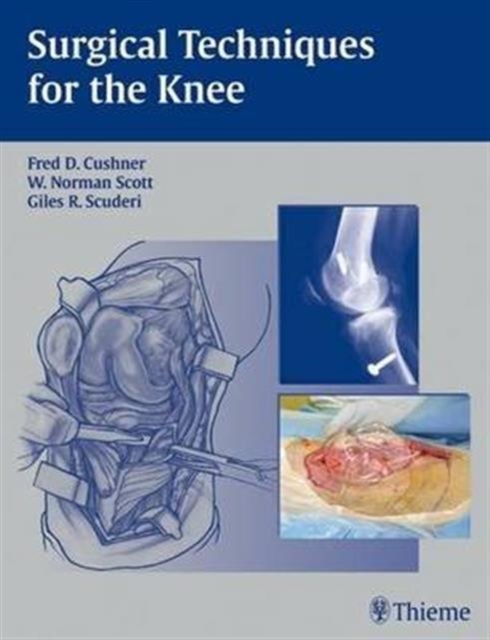 Surgical Techniques for the Knee, Hardback Book