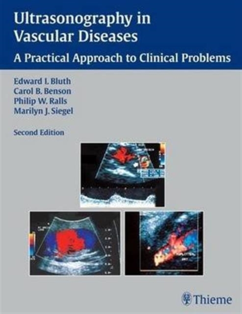 Ultrasonography in Vascular Diseases : A Practical Approach to Clinical Problems, Paperback Book