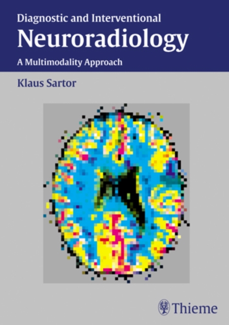 Diagnostic and Interventional Neuroradiology : A Multimodality Approach, Hardback Book