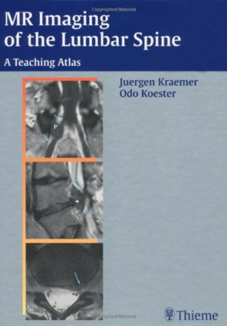MR-Imaging of the Lumbar Spine : A Teaching Atlas, Hardback Book